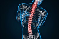 Scoliosis
